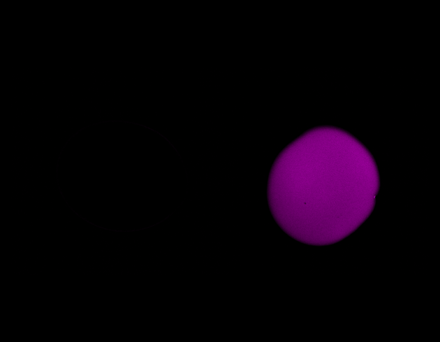 Channel 1 of the unmixed synthetic two-channel stack in Napari.