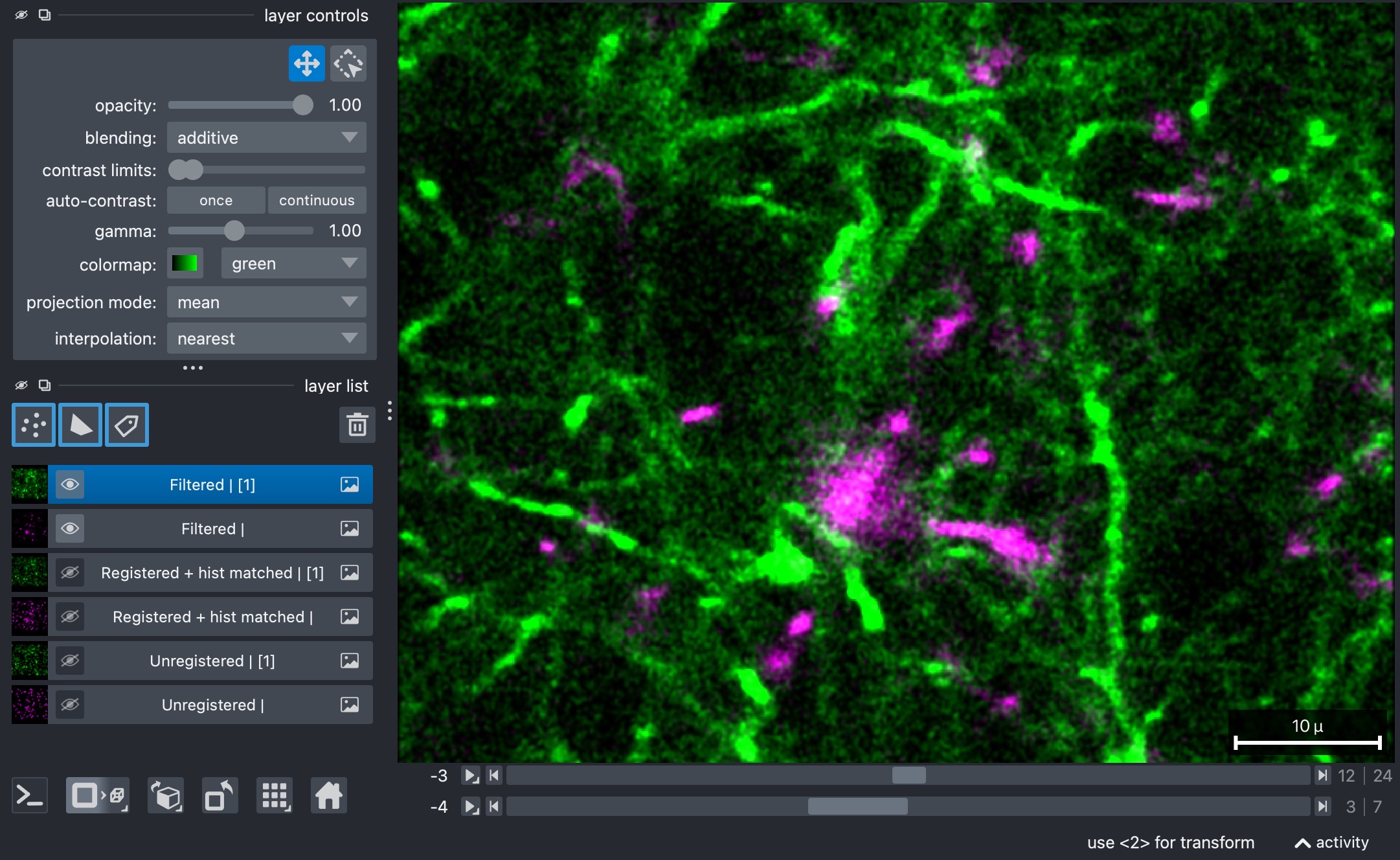 Histogram-matched two-channel example stack (3D+t) after slice-wise 2D filtering.
