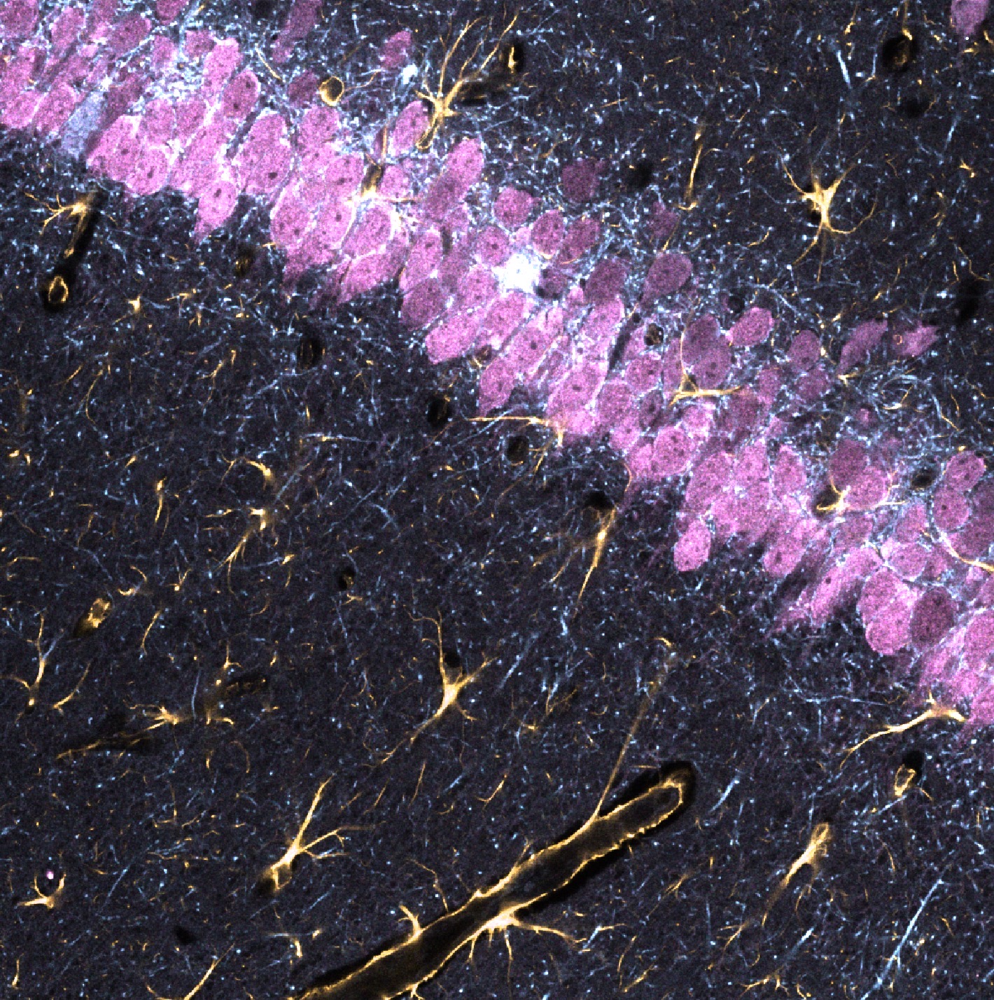 Raw composite view of the three-channel stack.