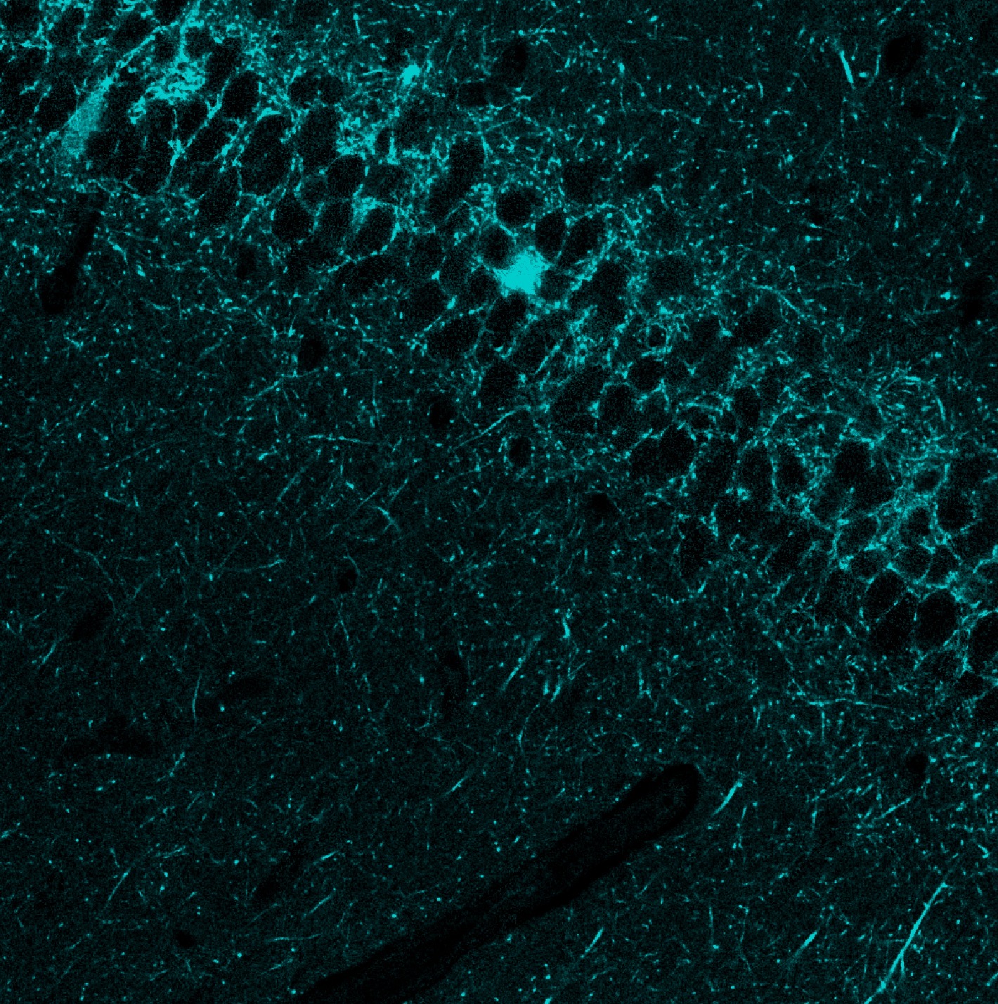 Channel 0 of the unmixed three-channel stack after the MATLAB-3C blind-unmixing run.