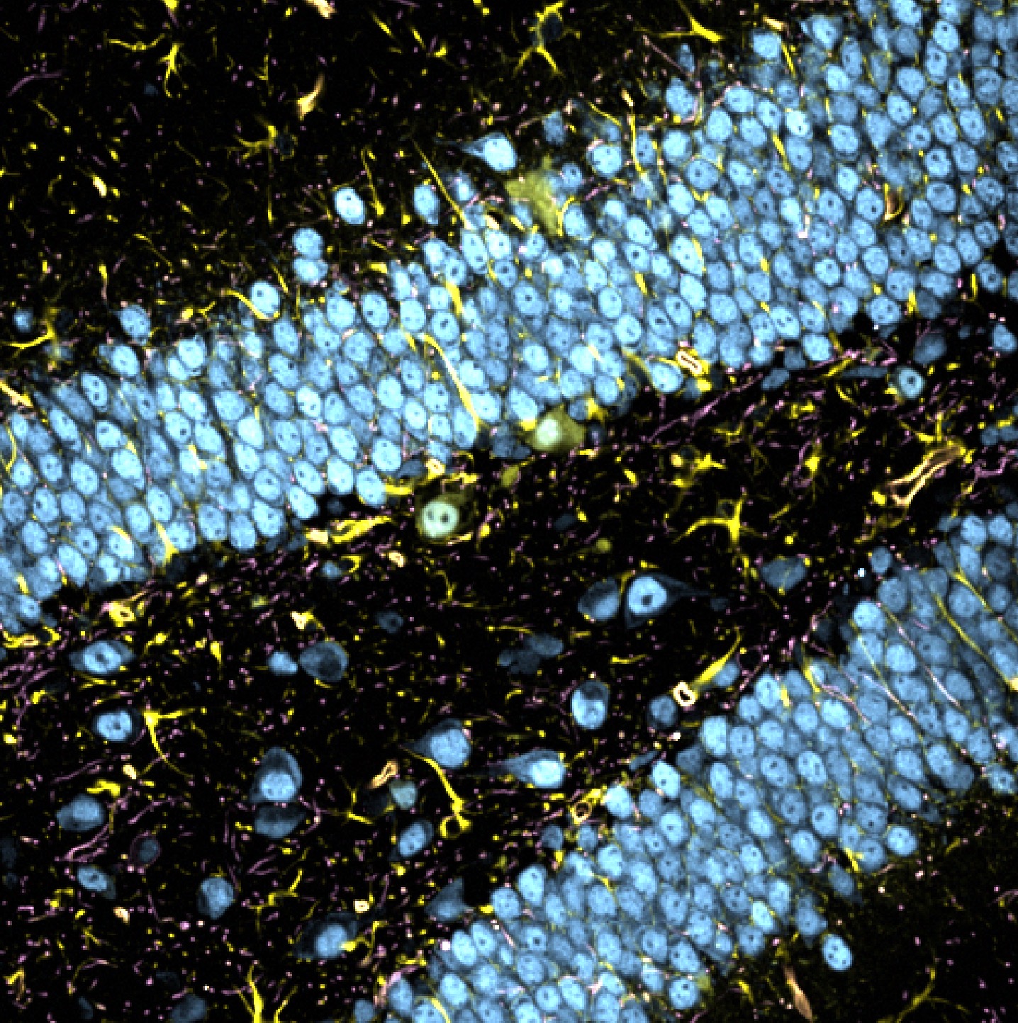 Raw composite view of the five-channel stack.