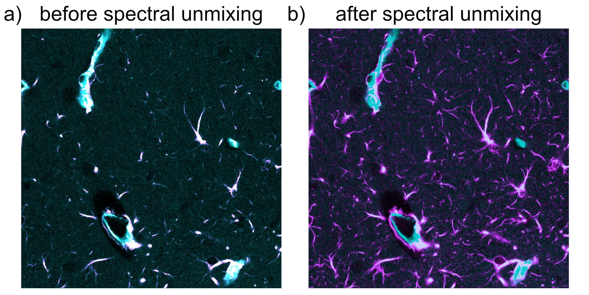 Example of spectral unmixing in a two-channel fluorescence image