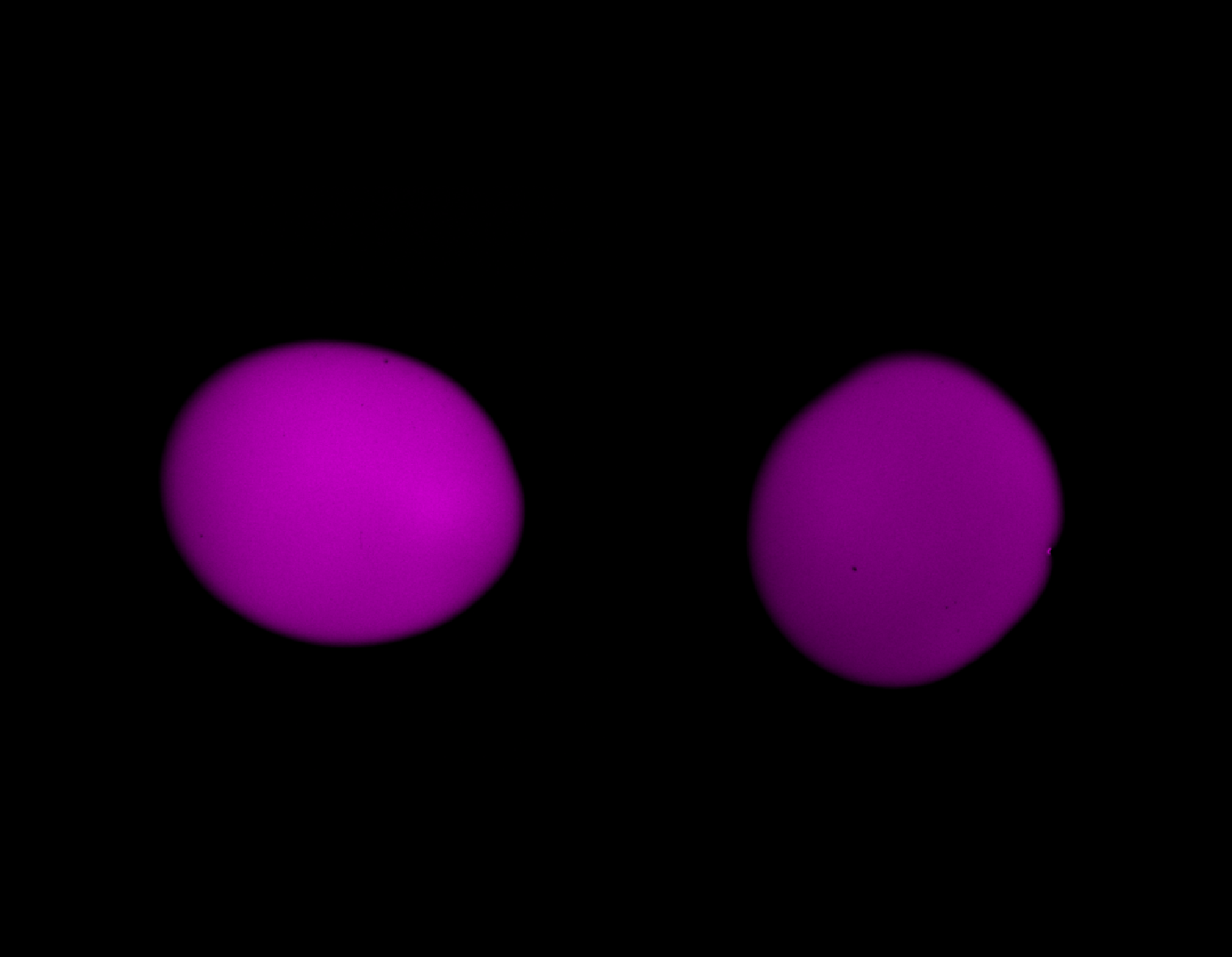 Channel 1 of the raw synthetic two-channel stack in Napari.