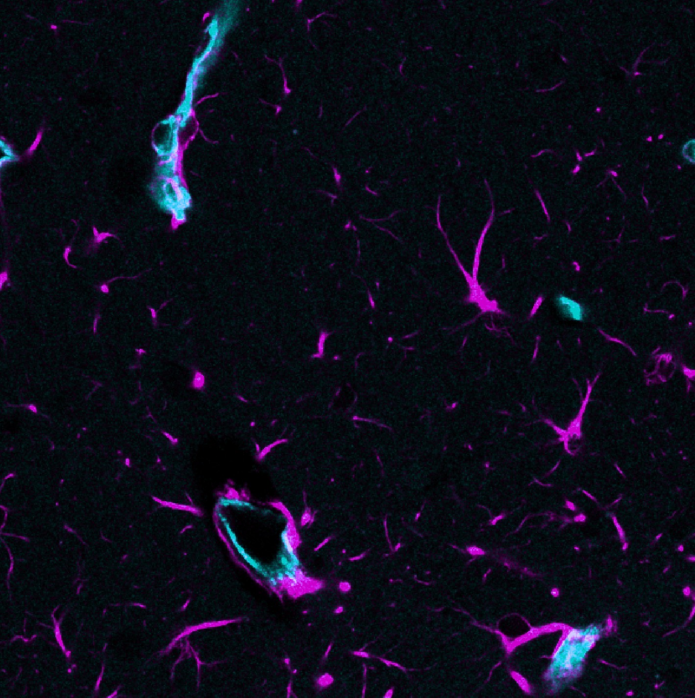 Composite image of the unmixed two-channel stack.