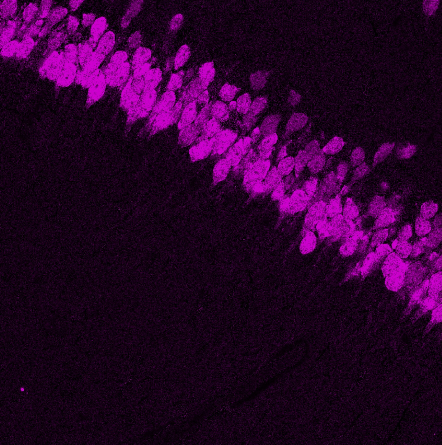 Channel 1 of the unmixed three-channel stack after the source-sink-N blind-unmixing run.